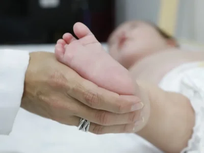 Atraso no teste do pezinho retarda diagnóstico da AME no SUS